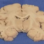 Lezioni di Neuroanatomia: video lezioni